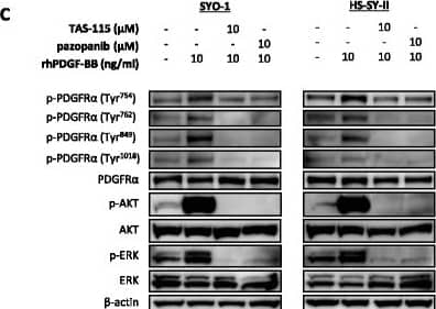 Detection of Phospho-PDGF R alpha (Y762) by Western Blot