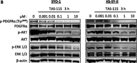 Detection of Phospho-PDGF R alpha (Y762) by Western Blot
