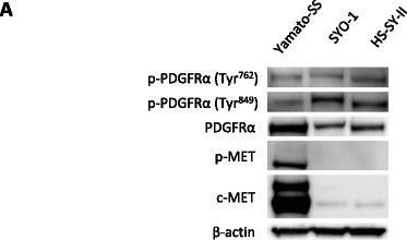 Detection of Phospho-PDGF R alpha (Y762) by Western Blot