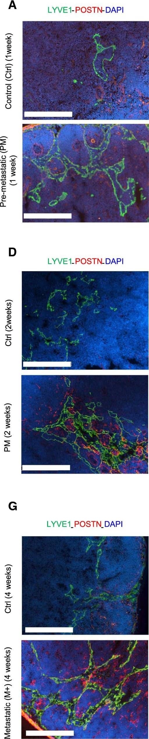 Detection of Mouse LYVE-1 by Immunocytochemistry/Immunofluorescence