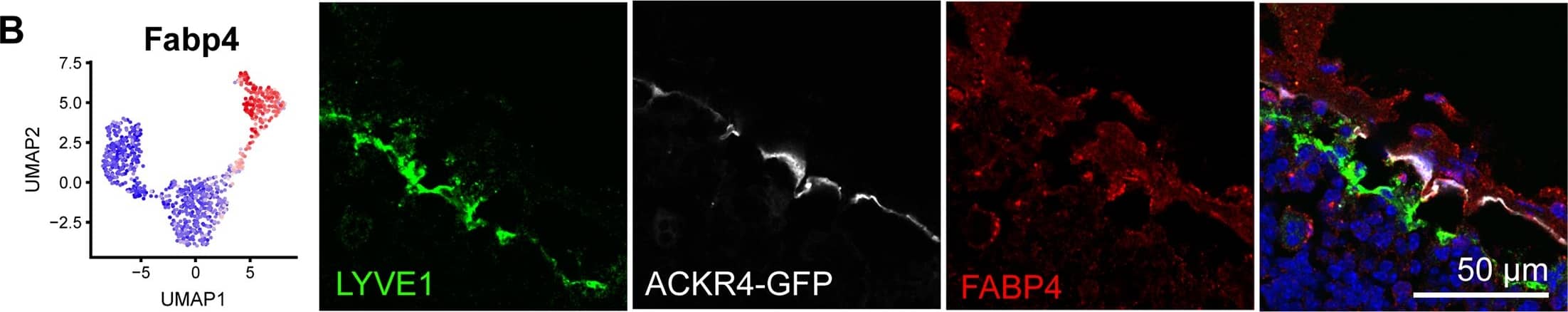 Detection of Mouse LYVE-1 by Immunocytochemistry/Immunofluorescence