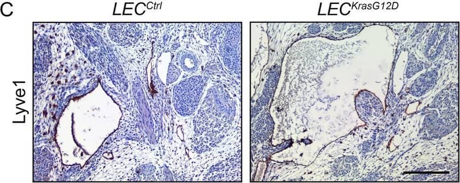 Detection of Mouse LYVE-1 by Immunohistochemistry