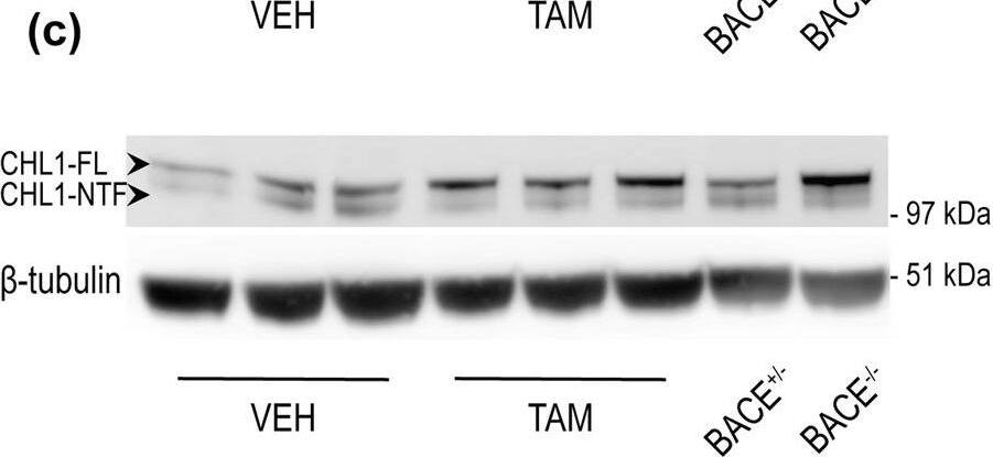 Detection of Mouse CHL-1/L1CAM-2 by Western Blot