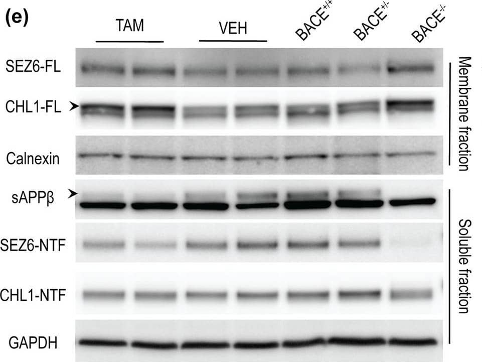 Detection of Mouse CHL-1/L1CAM-2 by Western Blot