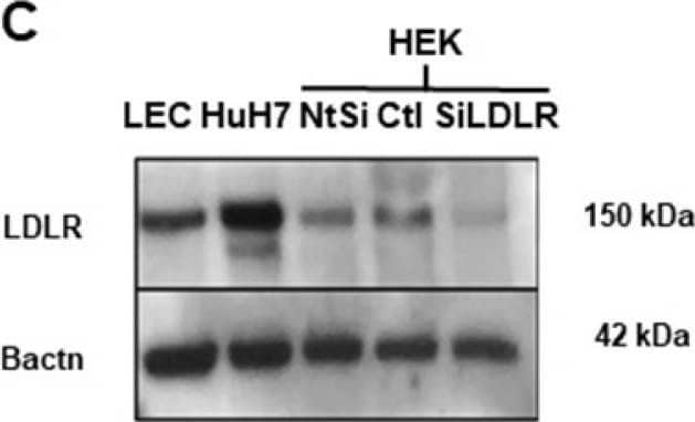 Detection of Human LDLR by Western Blot