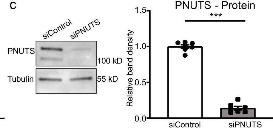 Detection of PNUTS by Western Blot