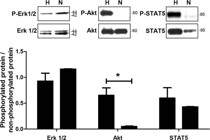 Detection of Human STAT5a/b by Western Blot