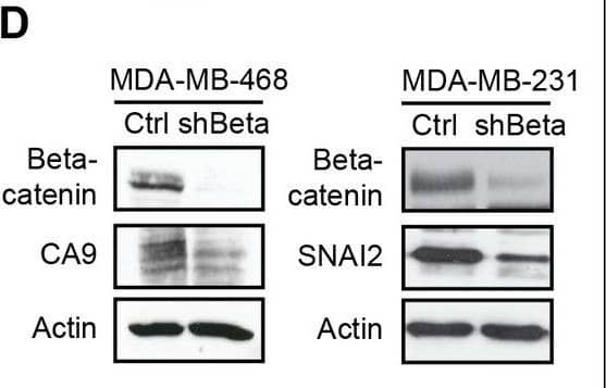 Detection of Carbonic Anhydrase IX/CA9 by Western Blot