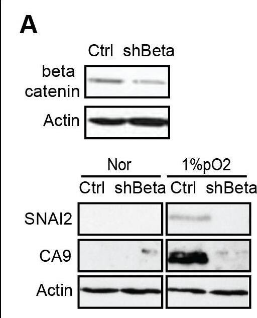 Detection of Carbonic Anhydrase IX/CA9 by Western Blot