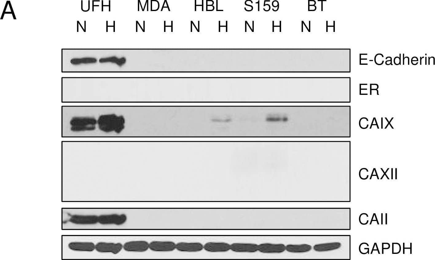 Detection of Carbonic Anhydrase XII/CA12 by Western Blot