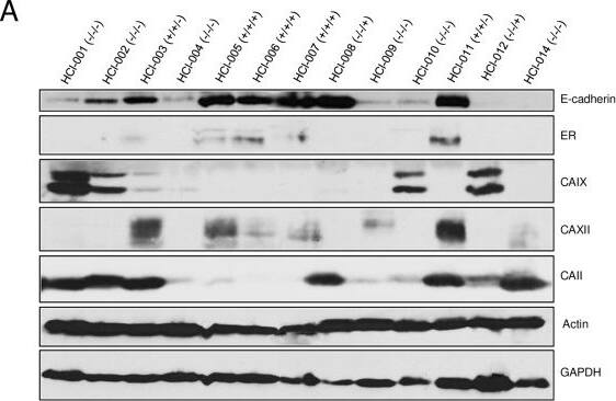 Detection of Carbonic Anhydrase XII/CA12 by Western Blot