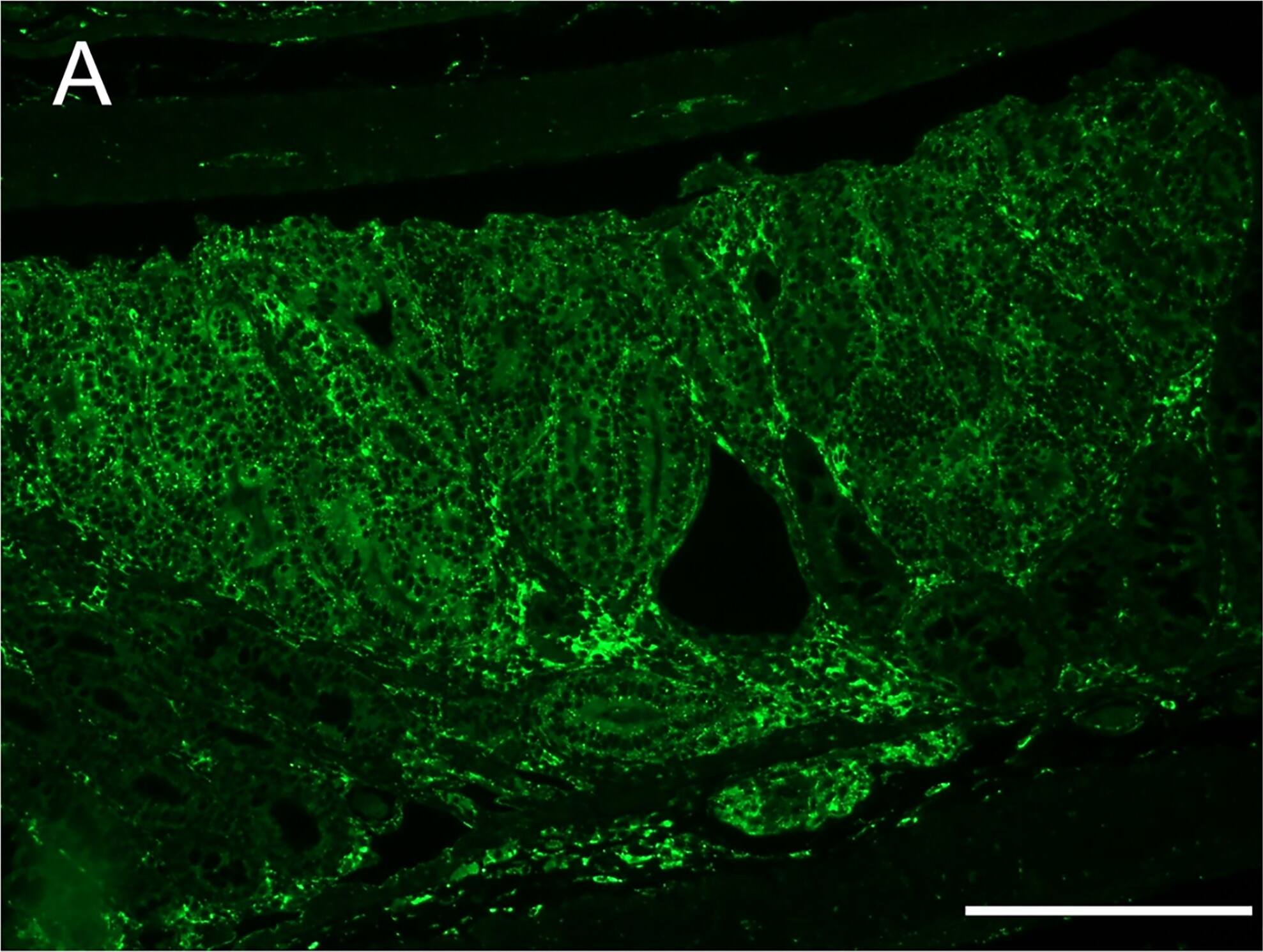 Detection of Mouse Human Legumain/Asparaginyl Endopeptidase Antibody by Immunohistochemistry
