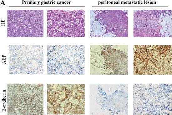 Detection of Human Legumain/Asparaginyl Endopeptidase by Immunohistochemistry