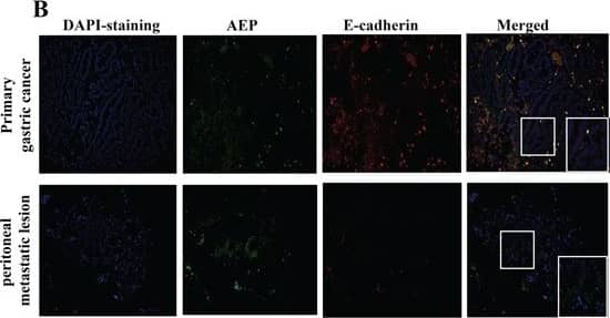 Detection of Human Legumain/Asparaginyl Endopeptidase by Immunocytochemistry/Immunofluorescence