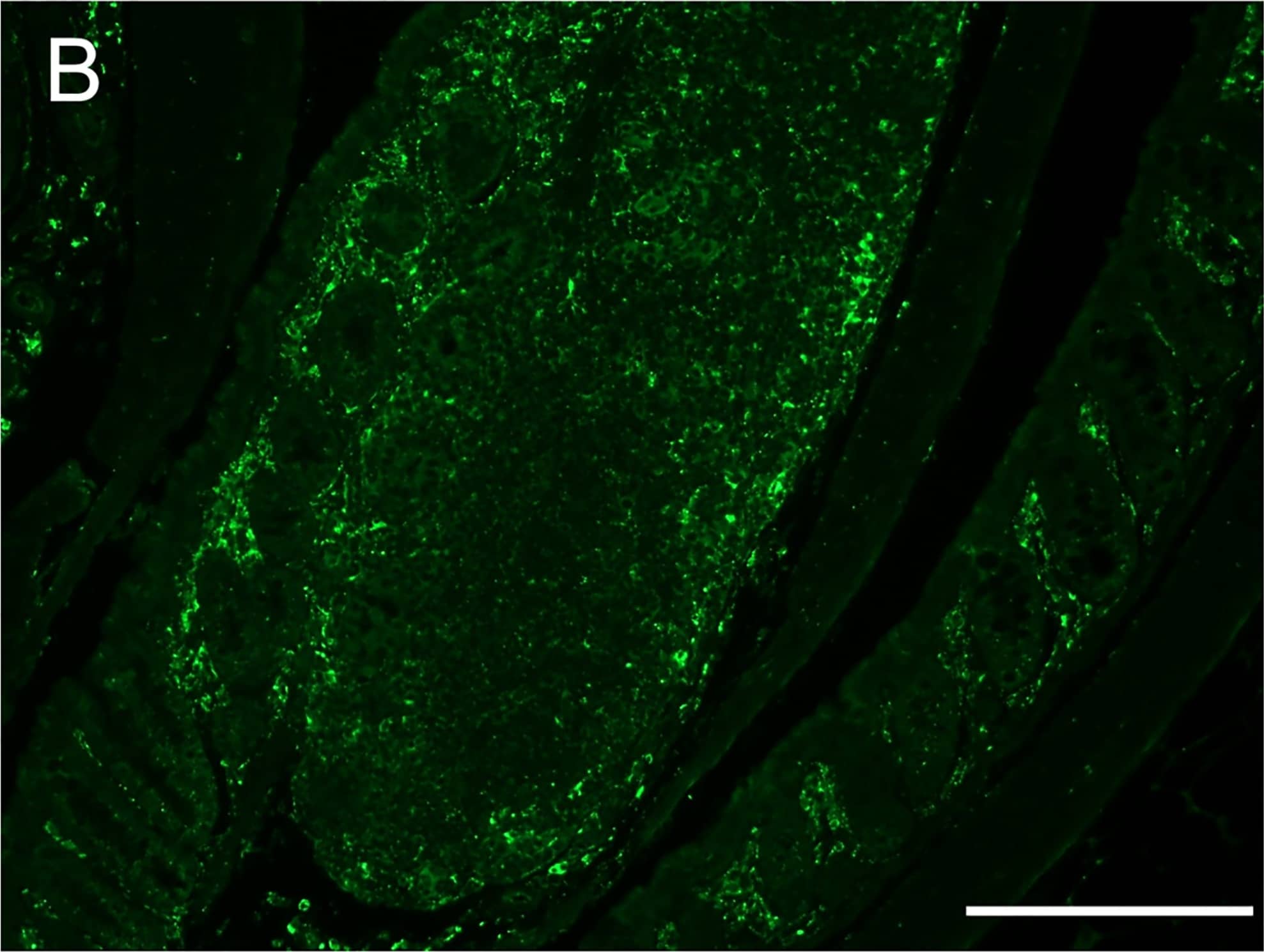 Detection of Mouse Legumain/Asparaginyl Endopeptidase by Immunocytochemistry/Immunofluorescence