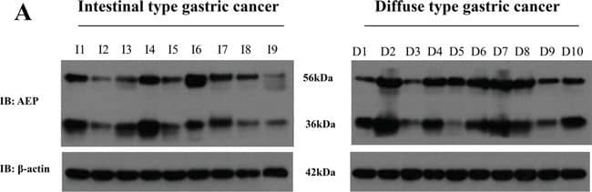 Detection of Human Legumain/Asparaginyl Endopeptidase by Western Blot