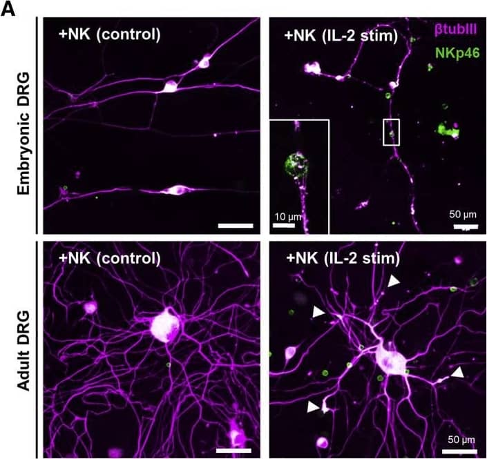 Detection of Mouse NKp46/NCR1 by Immunocytochemistry/Immunofluorescence
