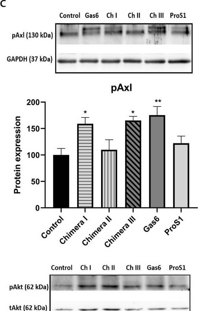 Detection of Phospho-Axl (Y779) by Western Blot