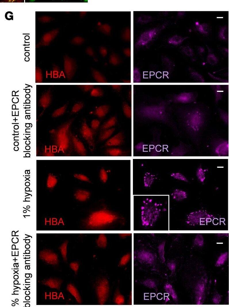 Detection of EPCR by Immunocytochemistry/ Immunofluorescence