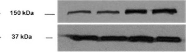 Detection of Mouse LDLR by Western Blot