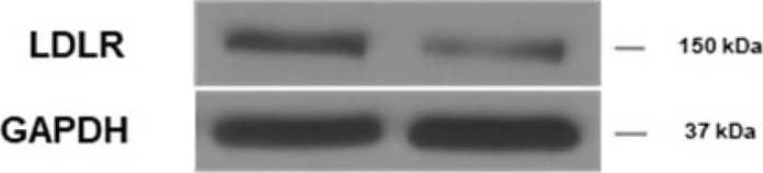 Detection of Mouse LDLR by Western Blot