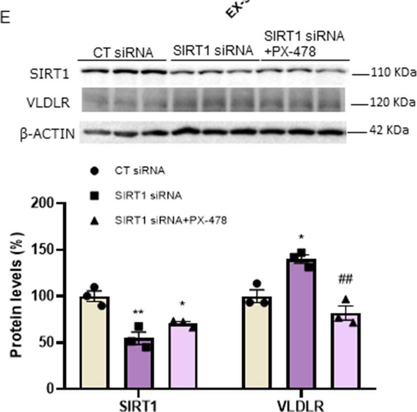 Detection of Mouse VLDLR by Western Blot
