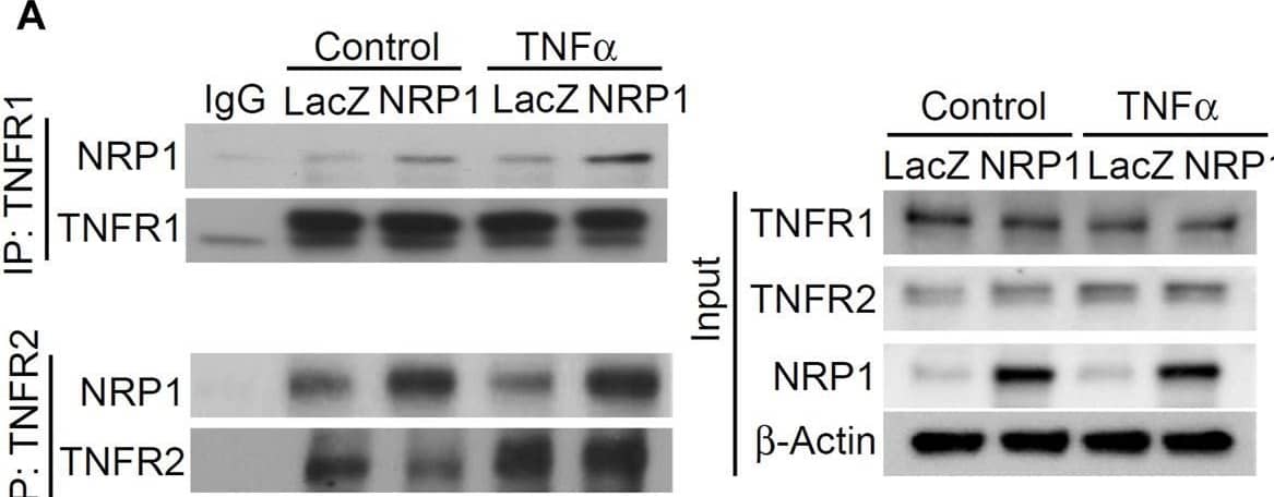 Detection of Human TNF RI/TNFRSF1A by Western Blot