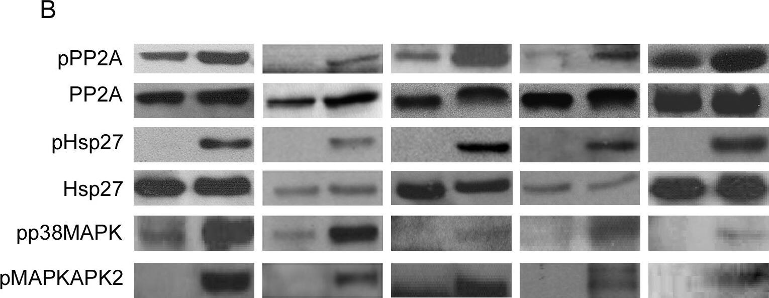 Detection of Human HSP27 by Western Blot