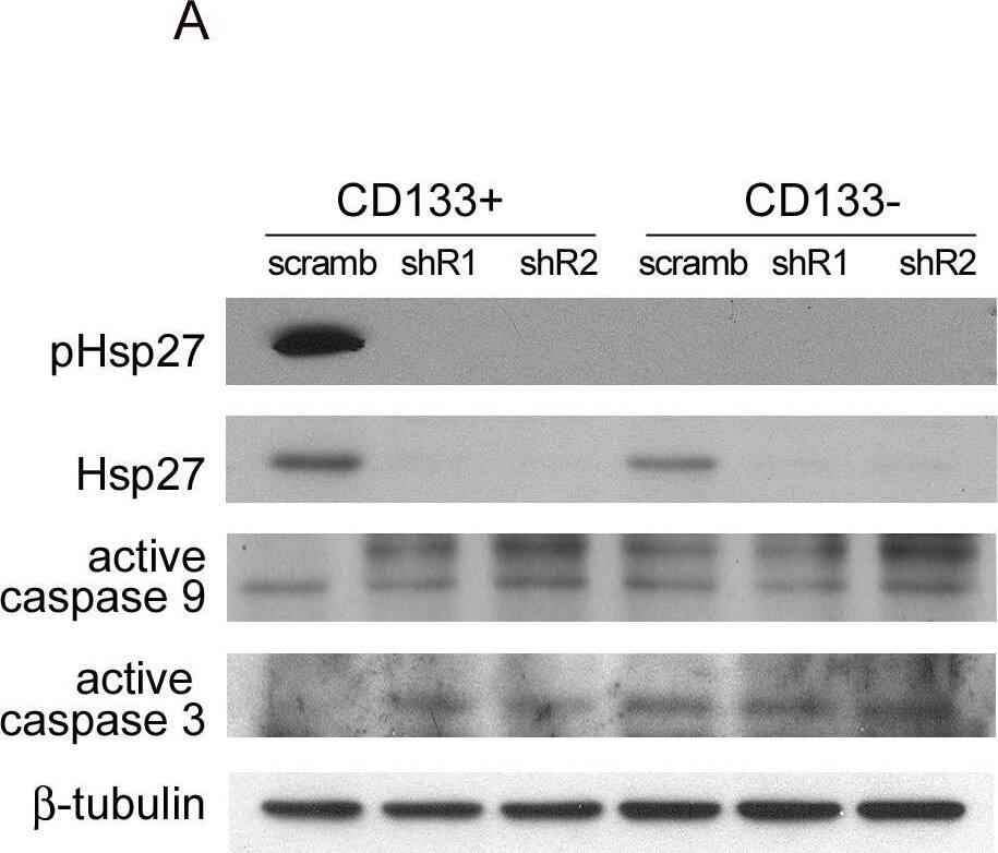 Detection of HSP27 by Western Blot