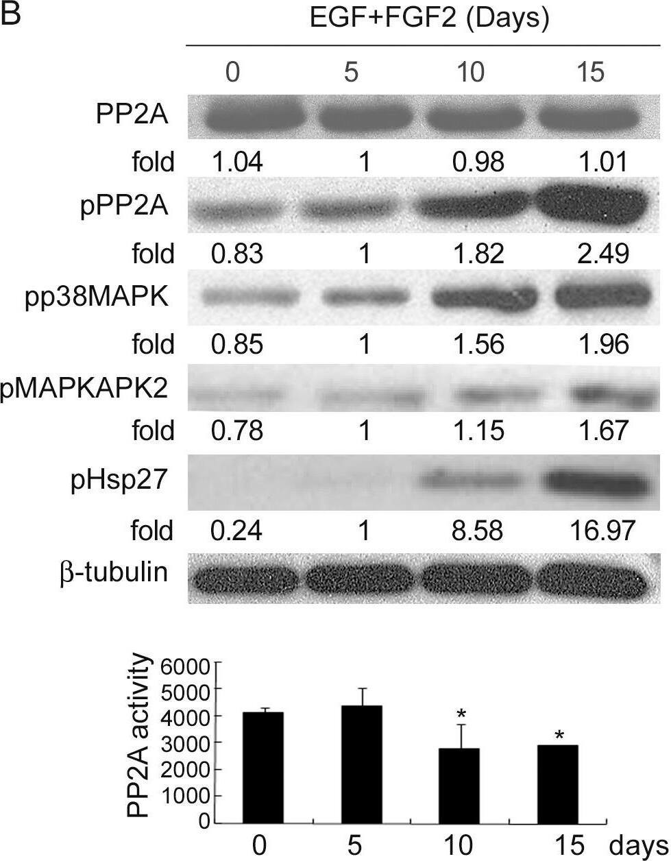 Detection of HSP27 by Western Blot