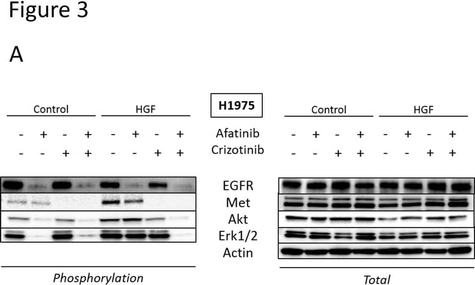 Detection of Human Human EGFR Antibody by Western Blot