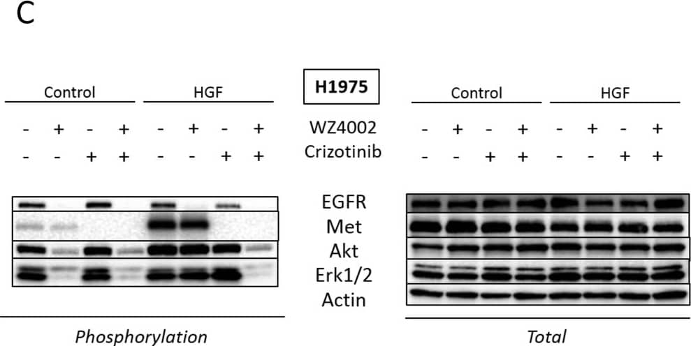 Detection of Human EGFR by Western Blot