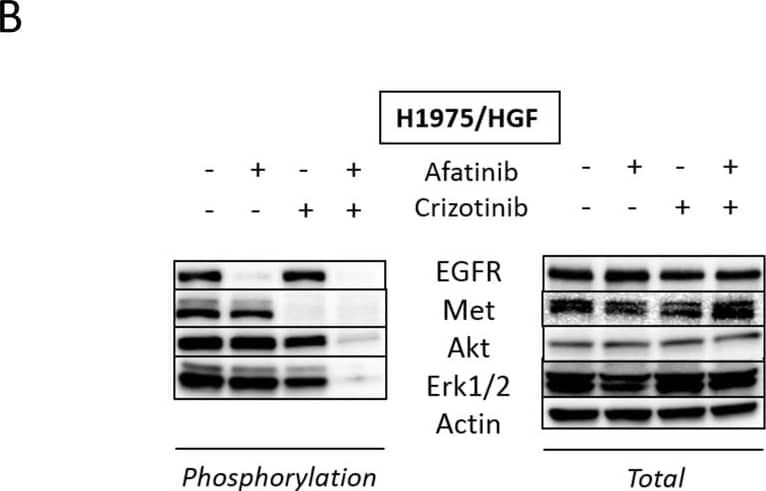 Detection of Human EGFR by Western Blot