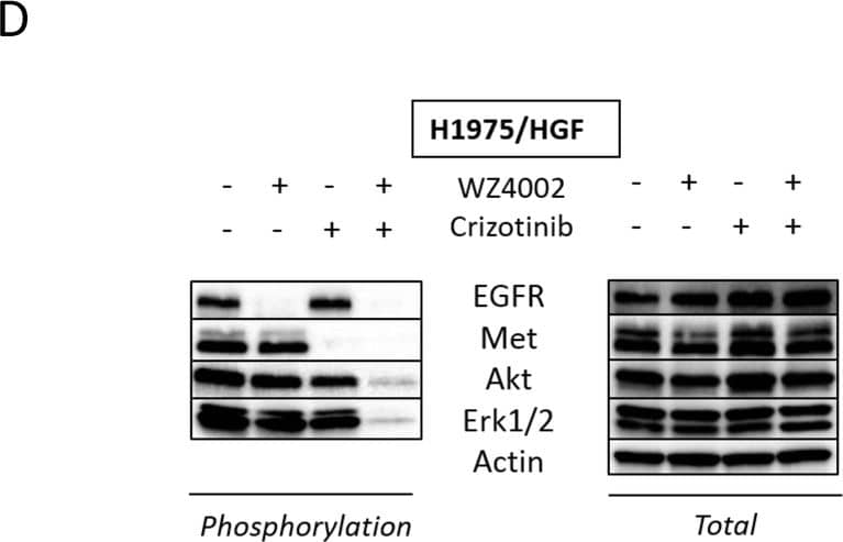 Detection of Human EGFR by Western Blot