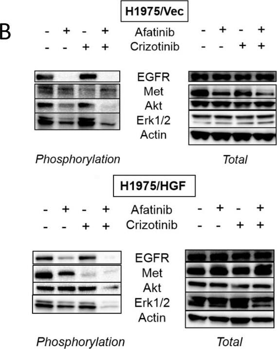 Detection of Mouse EGFR by Western Blot