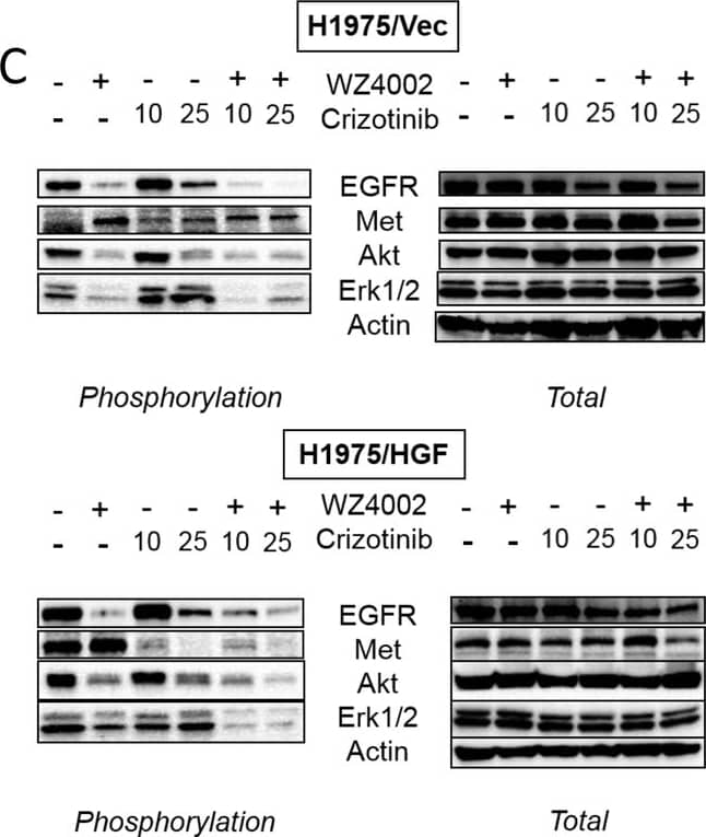 Detection of Mouse EGFR by Western Blot