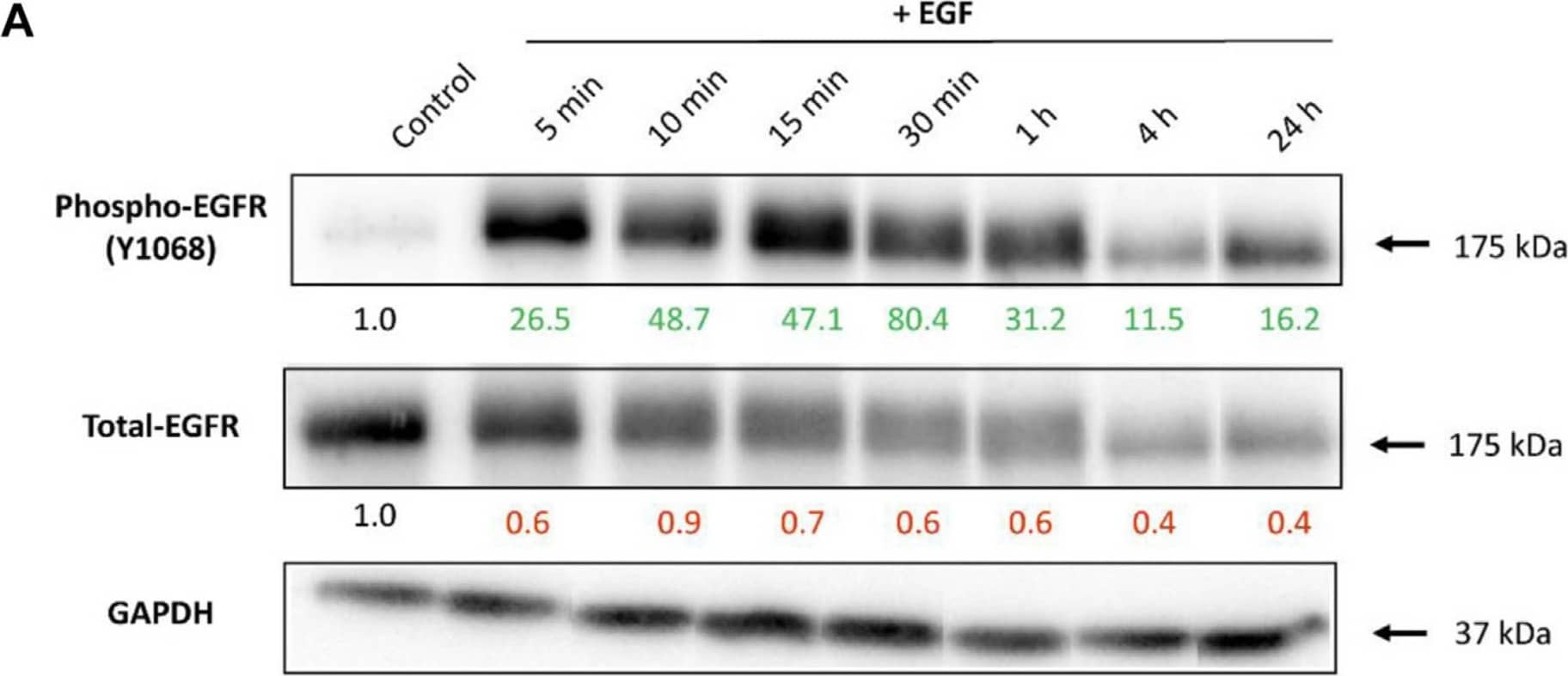 Detection of EGFR by Western Blot