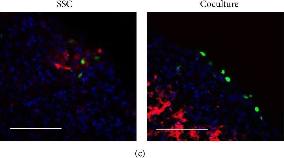Detection of Human FGF acidic/FGF1 by Immunocytochemistry/ Immunofluorescence