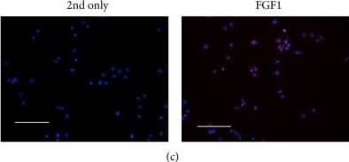 Detection of Human FGF acidic/FGF1 by Immunocytochemistry/ Immunofluorescence