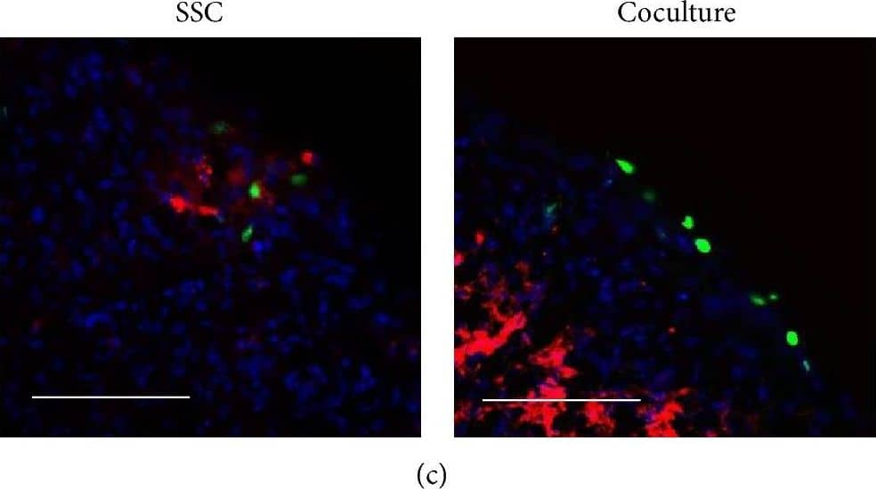 Detection of Human FGF acidic/FGF1 by Immunocytochemistry/ Immunofluorescence