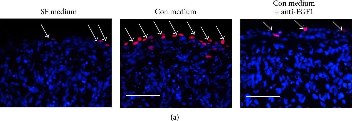Detection of Human FGF acidic/FGF1 by Immunocytochemistry/ Immunofluorescence