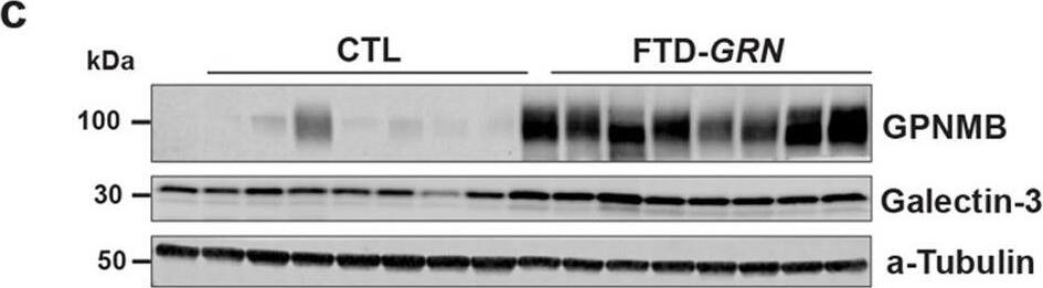 Detection of Human Osteoactivin/GPNMB by Western Blot
