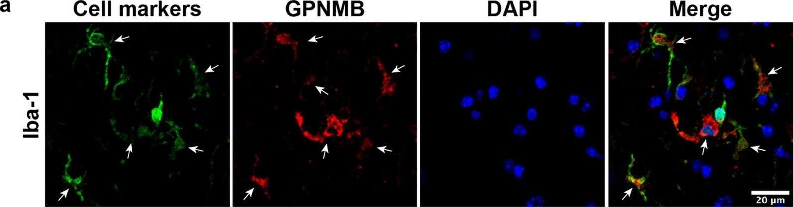 Detection of Mouse Osteoactivin/GPNMB by Immunohistochemistry