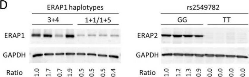 Detection of Aminopeptidase PILS/ARTS1 by Western Blot