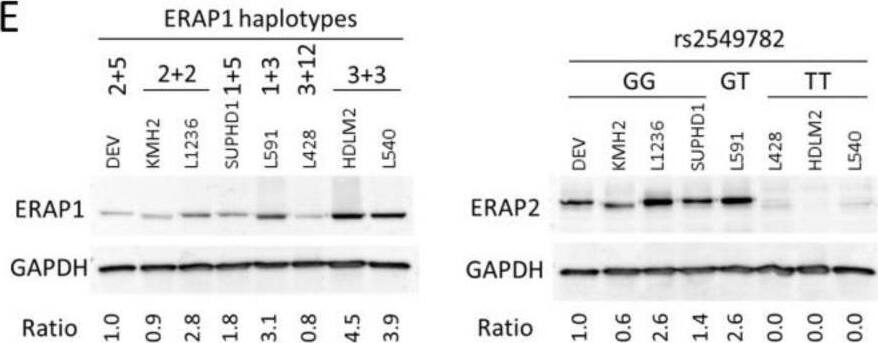 Detection of Aminopeptidase PILS/ARTS1 by Western Blot