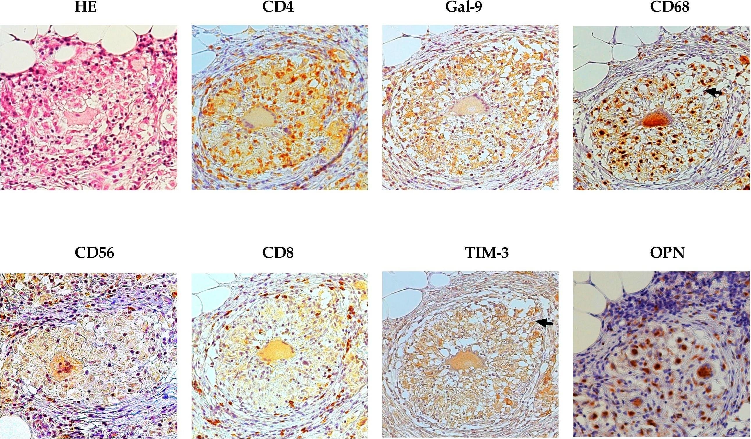Detection of Human TIM-3 by Immunohistochemistry