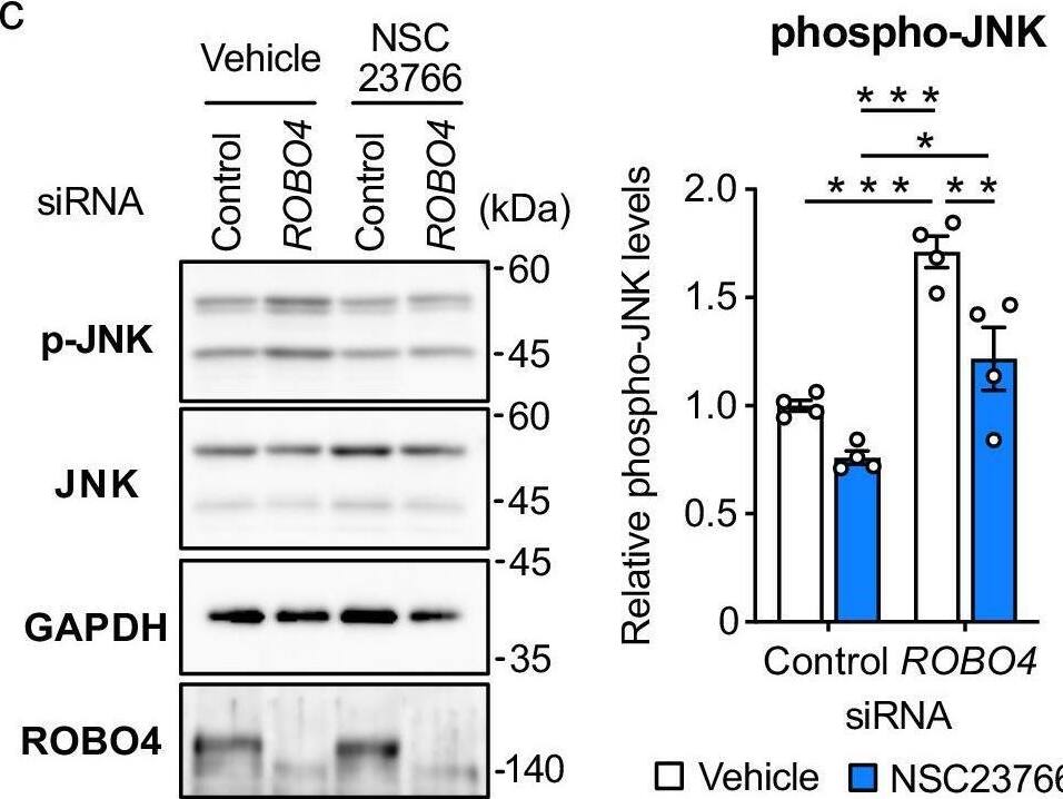 Detection of ROBO4 by Western Blot