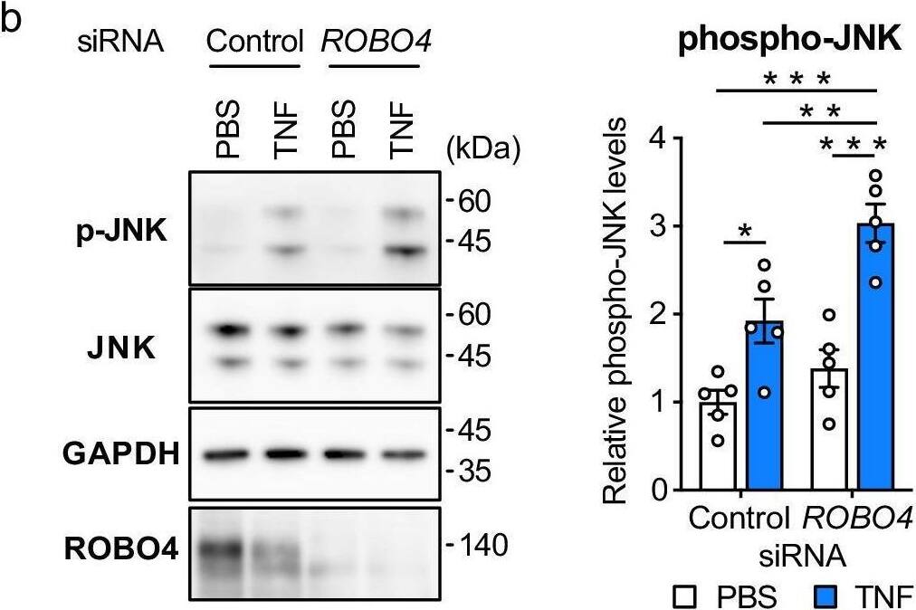 Detection of ROBO4 by Western Blot