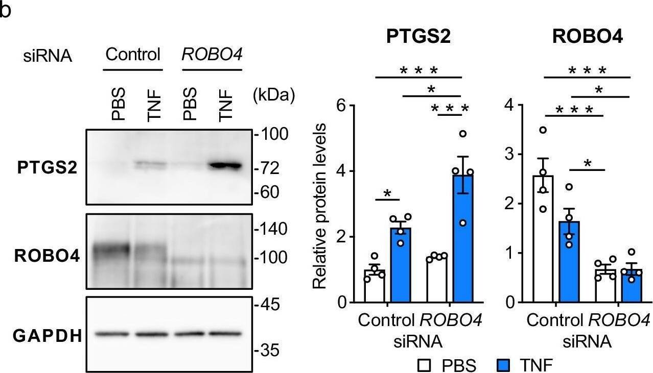 Detection of ROBO4 by Western Blot