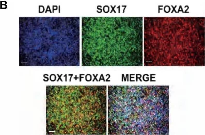 Detection of HNF-3 beta/FoxA2 by Immunocytochemistry/ Immunofluorescence